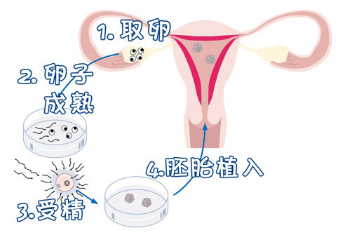 严重少弱精案例